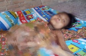 Nina Butuh Uluran Tangan, Kapolsek Tabir Ulu Janji akan Bawa Pasien ke Rumah Sakit